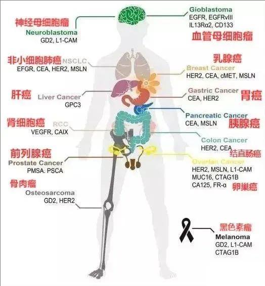 CAR-T疗法暴击多种实体瘤,打破难治性壁垒