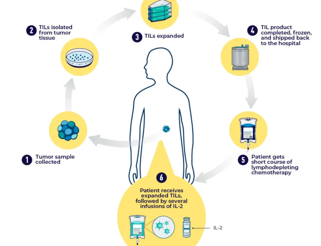 370万天价的TILs细胞疗法到底是什么