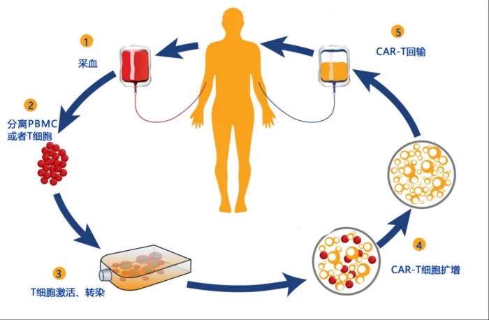 CAR-T疗法,癌症治疗的新利器